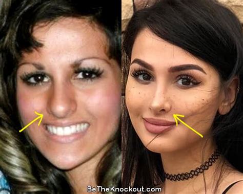 sssniperwolf surgery|ssniperwolf before plastic surgery.